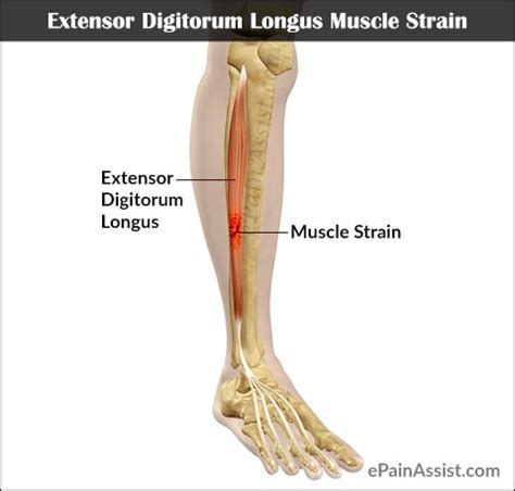 Image result for Extensor Digitorum Longus