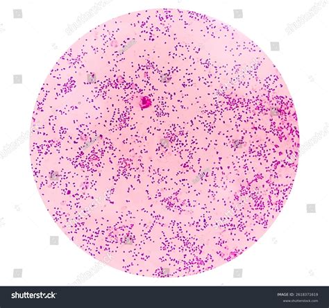 Neisseria Gonorrhoeae Species Gram-negative Diplococci Bacteria Stock ...