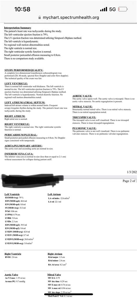 Hyperdynamic left ventricle? : r/Heartfailure