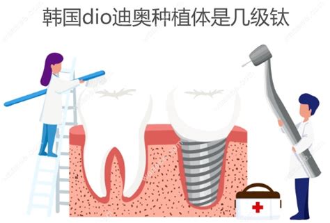 韩国dio种植体又叫什么,中文名叫迪奥,是款纯钛材质的种植体 - 口腔资讯 - 牙齿矫正网