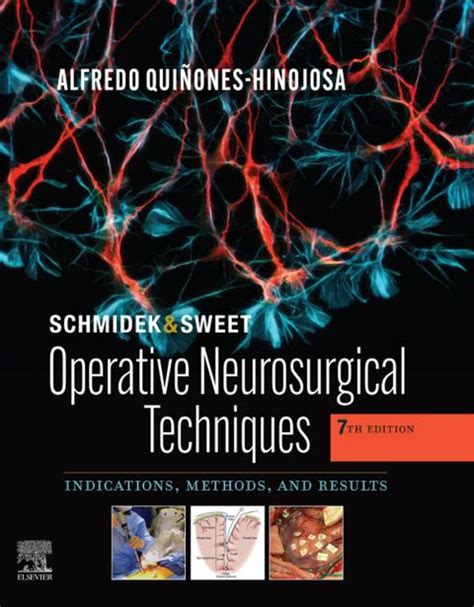 Schmidek and Sweet: Operative Neurosurgical Tech: 7th edition | Alfredo ...