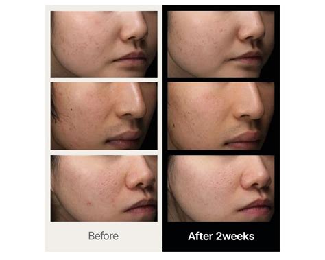 345 Relief Cream Dr Althea - Crema Alivio Coreana | Rutilans