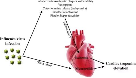 Elevated Cardiac Troponin levels indicate mortality risk in influenza ...