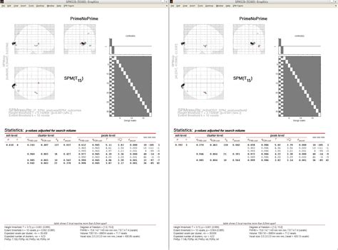 Image result for MATLAB SPM Model Analysis