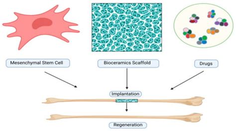 The Role of Bioceramics for Bone Regeneration: History, Mechanisms, and ...