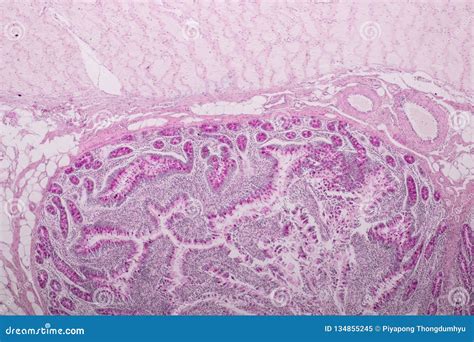 Image result for Jejunum Microscope