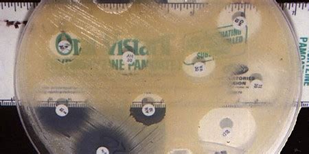 Image result for Microbotics Projects