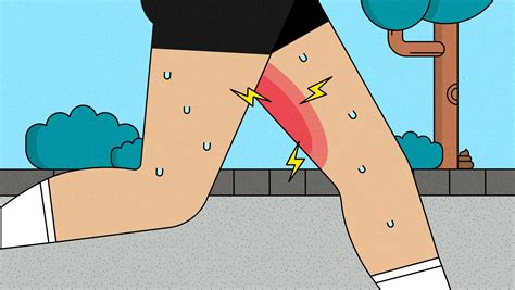 Chafing Rash Inner Thigh at Victoria Horton blog