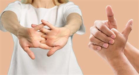 Cracking your knuckles is 'generally harmless' and does not cause ...