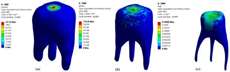 Finite Element Analysis of Dental Diamond Burs: Stress Distribution in ...