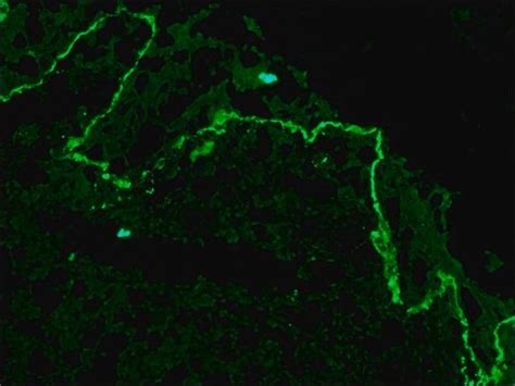 Monoclonal Anti-Collagen, Type VII antibody produced in mouse clone LH7 ...