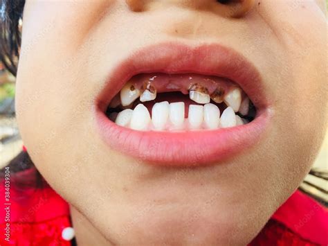 Toothache 的图像结果