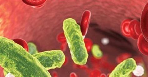 Septic Shock Meaning in Hindi What is Septic Shock: जानिए क्यों और क्या ...