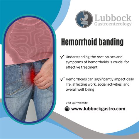 Hemorrhoid Banding: Lubbock, TX’s Trusted Procedure for Relief | by ...