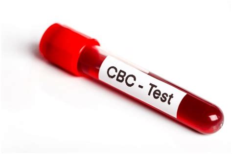 CBC Lab Test 的图像结果