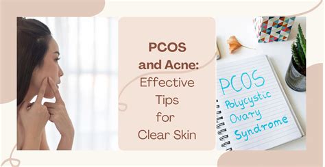 PCOS and Acne: Effective Tips for Clear Skin | Clinikally