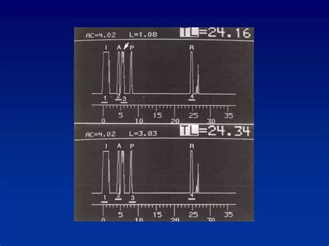 Image result for Biometry Procedure