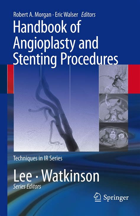 Handbook of Angioplasty and Stenting Procedures (Techniques in ...