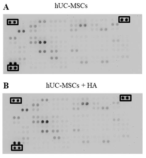Human Umbilical Cord Mesenchymal Stem Cells in Combination with ...