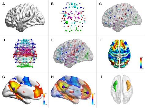北京师范大学神经影像脑连接组可视化软件（BrainNet Viewer）
