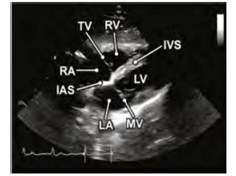 Tricog Support | Troubleshooting