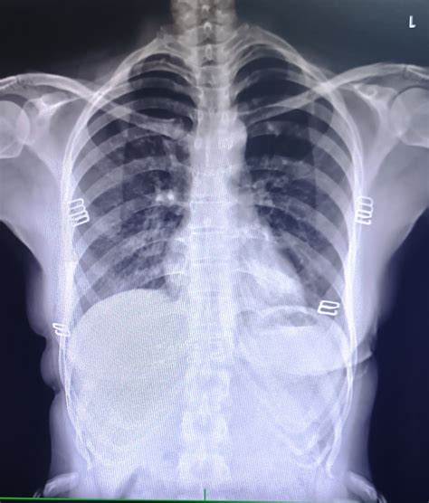 Patient Detail