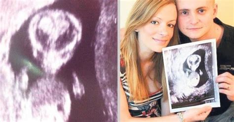 Image result for Alien Baby Ultrasound Scene