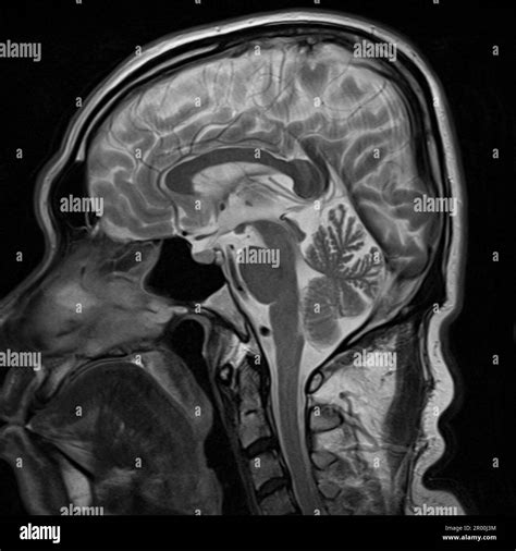 Image result for Human Brain Scan