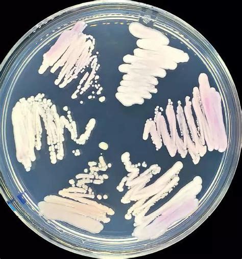 美国多地爆发沙氏门菌感染 了解沙门氏菌食物中毒(3)_社会万象_99养生堂