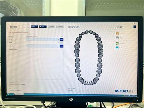 Image result for CS Scanner