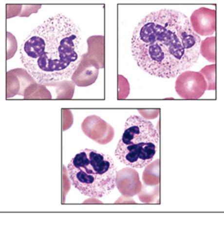 Image result for WBC Count Microscope