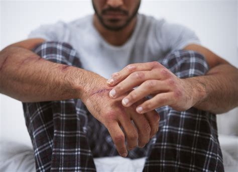 Borderline Personality Disorder in Men - Symptoms & Care