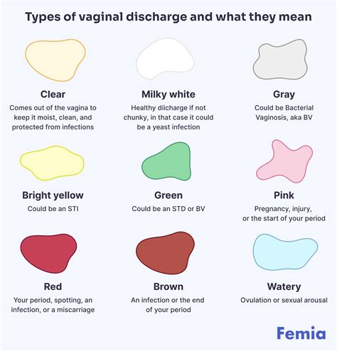 What discharge colors mean – Artofit