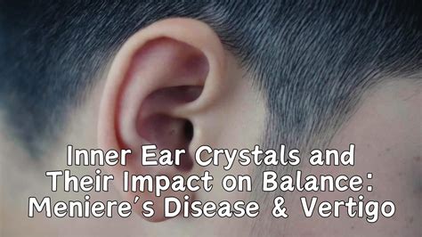 Ear Crystals Treatment
