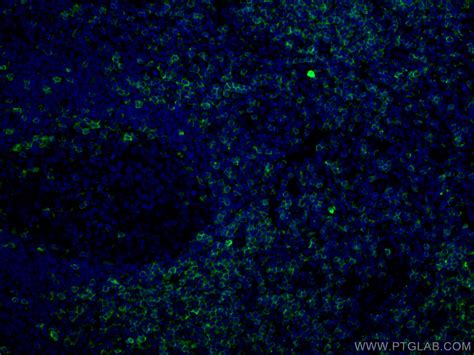 CD5 antibody (67278-1-Ig) | Proteintech