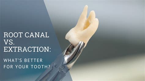 Image result for Tooth Root Extraction