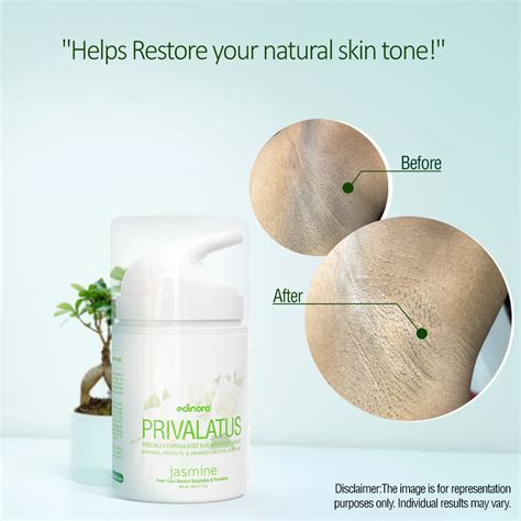 Edinora Privalatus Natural Private areas Skin Whitening Cream ...