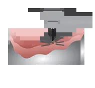 Laser Solutions for Jewellery Industry | Markolaser