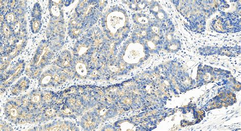 Claudin 9 antibody (30520-1-AP) | Proteintech