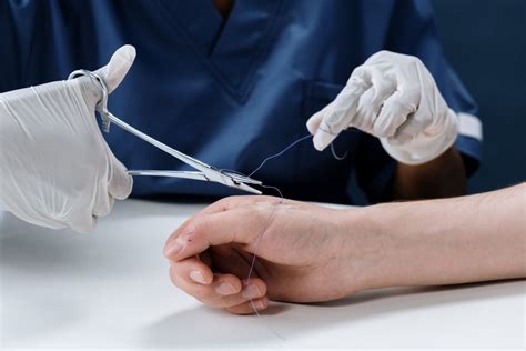 How To Know If A Cut Needs Stitches: Urgent Care - University Urgent Care