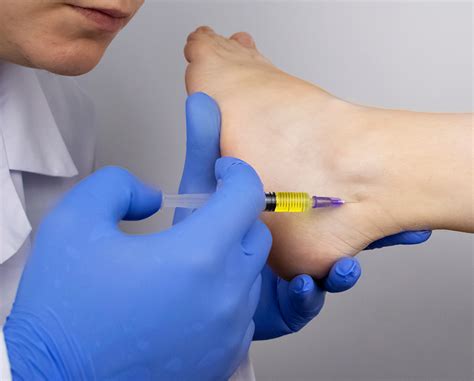 Image result for Ankle Injection Lateral Approach
