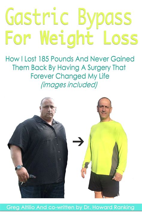 Gastric Bypass For Weight Loss (With Pictures): How I Lost 185 Pounds ...