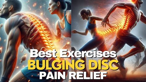 Image result for Exercise for Bulging Disk