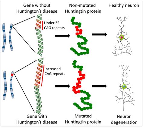 Huntington’s disease: how could stem cells help? | Eurostemcell