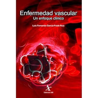 Amazon.in: Buy Enfermedad vascular. Un enfoque clínico [Paperback] [Jan ...