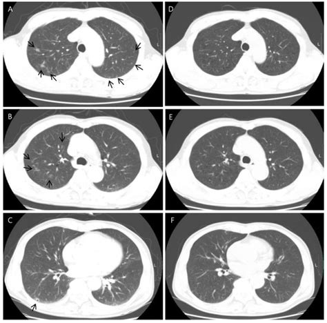 Diagnostics | Special Issue : Clinical Diagnosis, Prognosis and Data ...