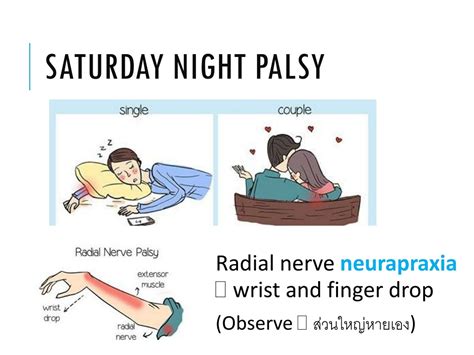 PPT - Understanding Nerve Injury and Treatment Options in Nan Hospital ...