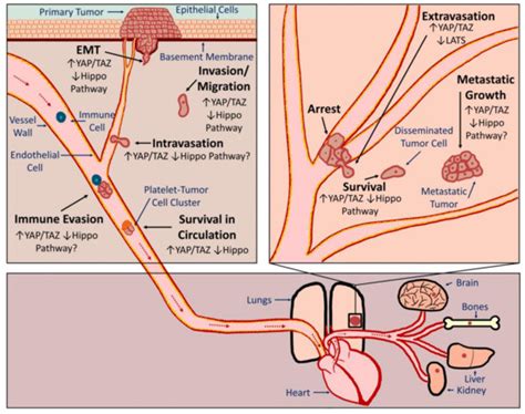 YAP/TAZ Activation as a Target for Treating Metastatic Cancer