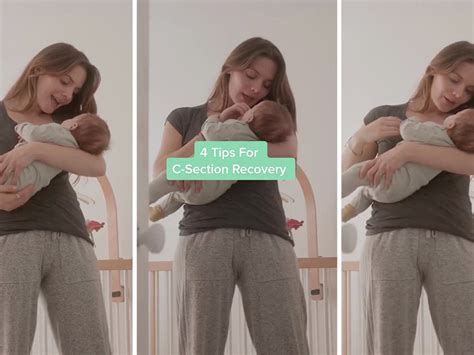 C-Section Wound 的图像结果