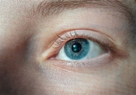 Can Dry Eyes Cause Blindness?